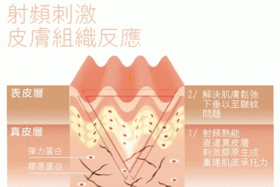 膠原蛋白重建