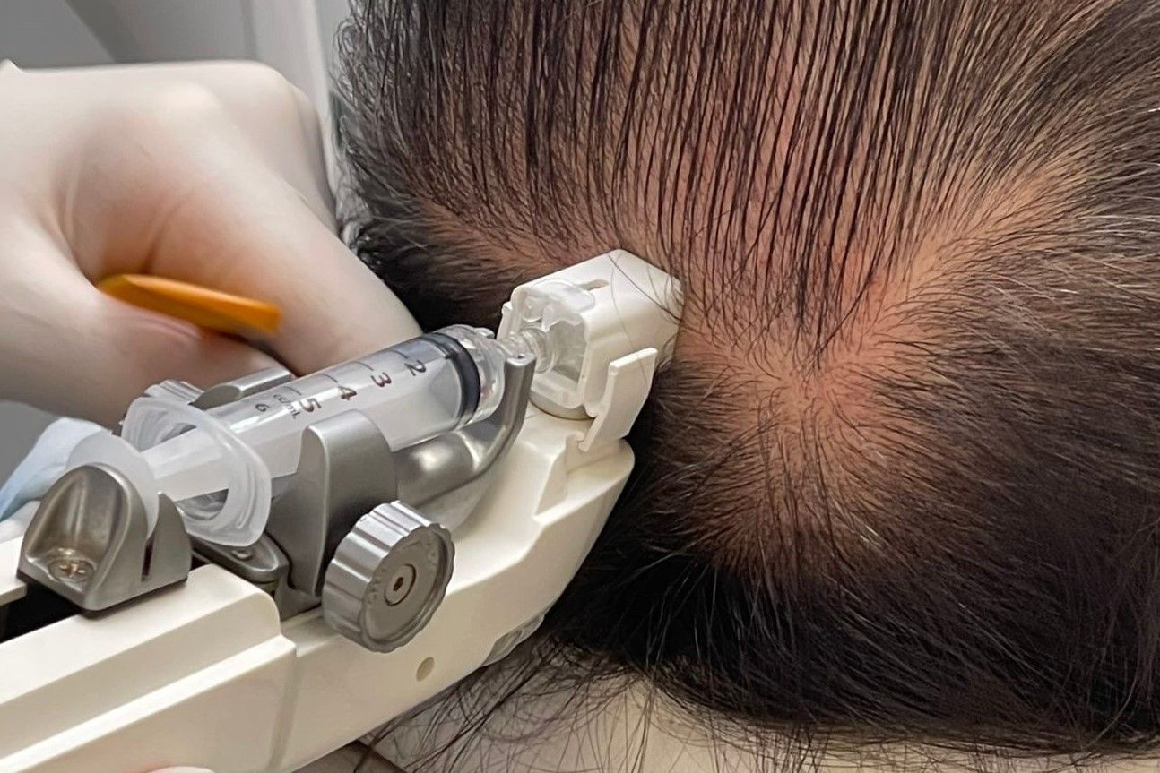 Mesotherapy Gun