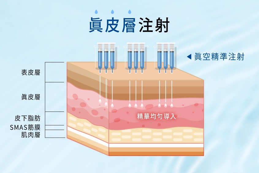Mesotherapy Skin Anatomy